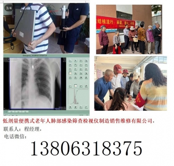 低剂量便携式老年人肺部感染筛查检视仪